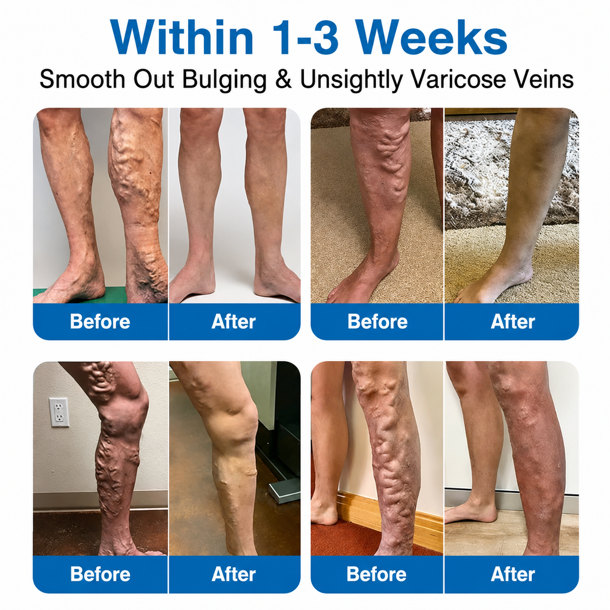 🇨🇦🏆✅️🏃Unitedne® VeinRepair Microneedle Patch Roll⚡Instant Relief, Long-Term Results