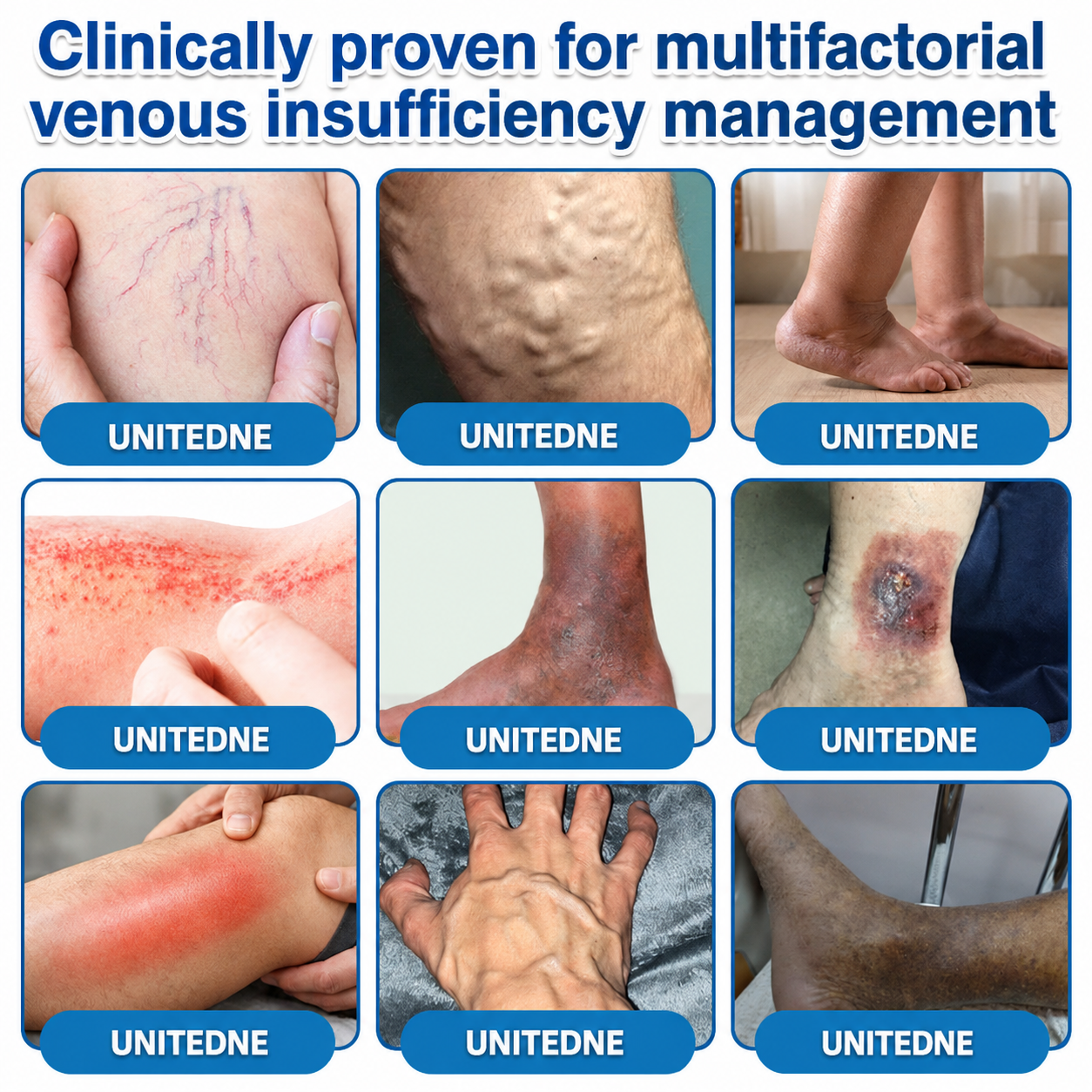 🇨🇦🏆✅️🏃Unitedne® VeinRepair Microneedle Patch Roll⚡Instant Relief, Long-Term Results