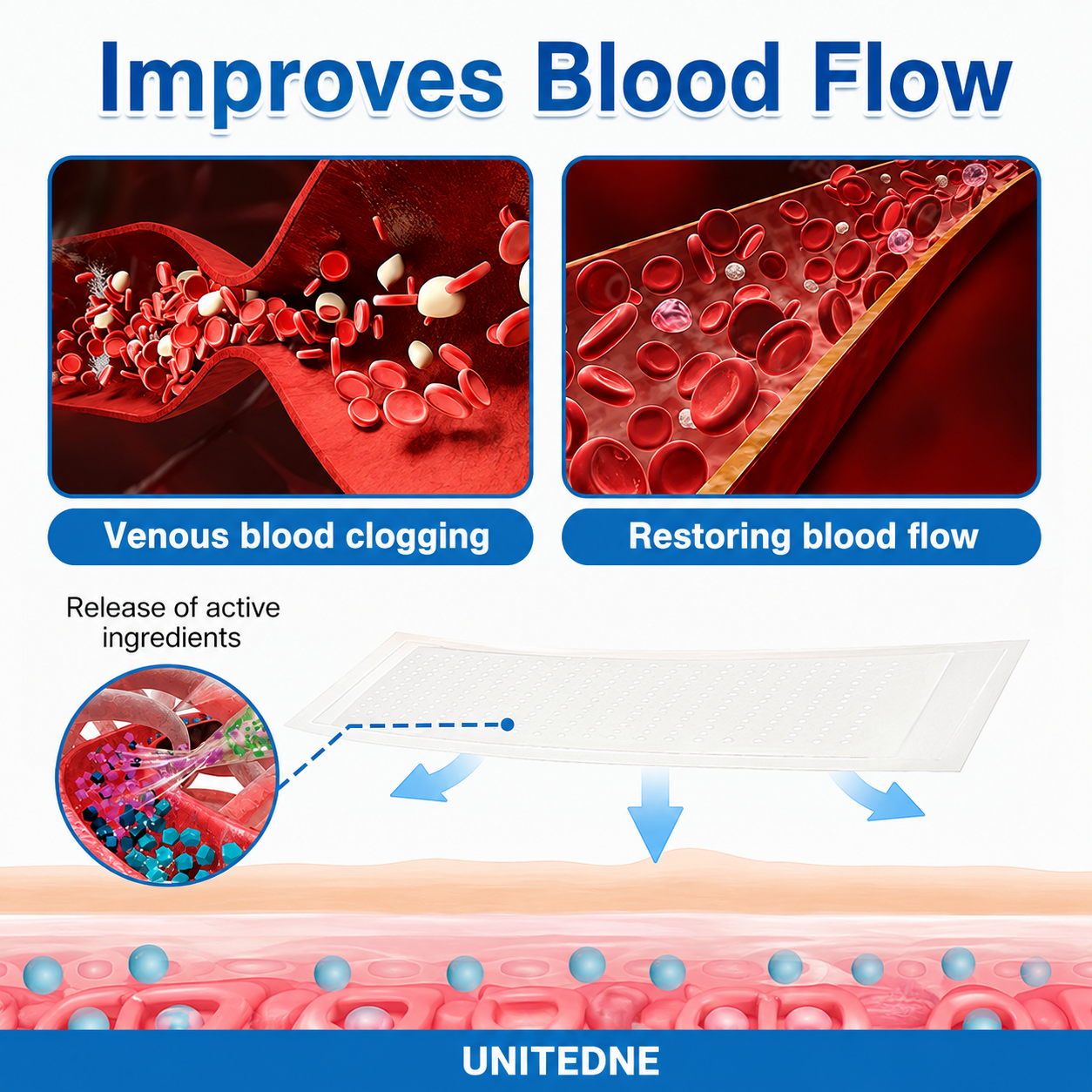 🇨🇦🏆✅️🏃Unitedne® VeinRepair Microneedle Patch Roll⚡Instant Relief, Long-Term Results